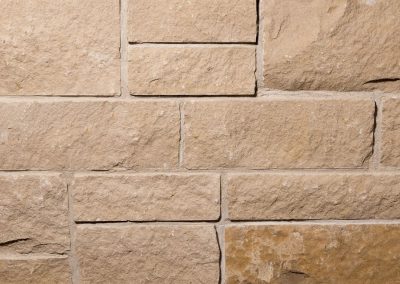 Veneer Coldwater Colorado Springs